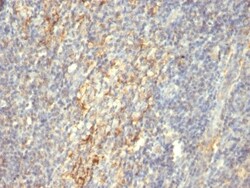 Transglutaminase 2/TGM2 Antibody (SPM358), Novus Biologicals 0.2mg; Unlabeled:Antibodies,